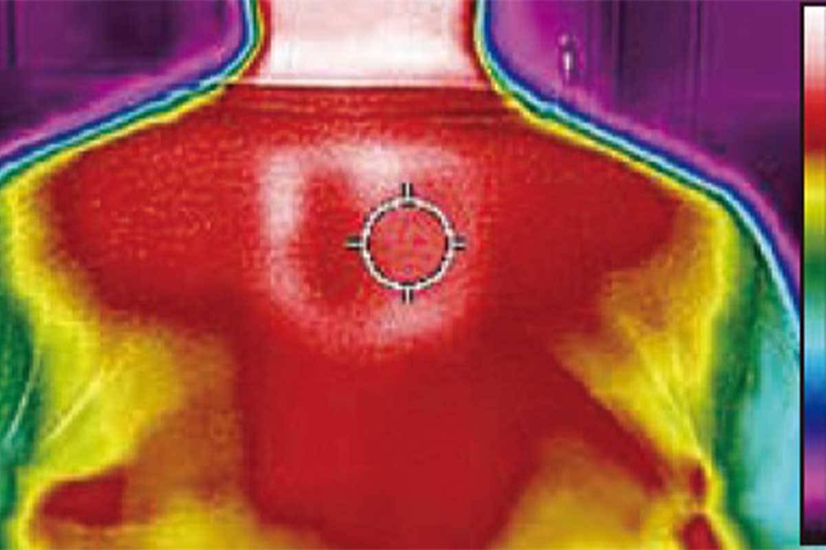 最低温度の10度をキープ。プレートを中心に肩甲骨周辺をかなり冷やせる。冬場に使う場合、上は43度まで温めることができる