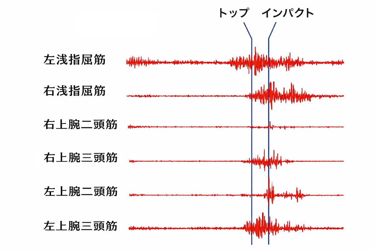 プロゴルファーとアマチュアゴルファーの前腕筋肉の筋電図解析（Electromyographic Analysis of Forearm Musclesin Professional and Amateur Golfers AdamJ.Farber,MD,J.SteveSmith,MD,RonaldS.Kvitne,MD,KarenJ.Mohr,PT,StevenS.Shin,MD,）